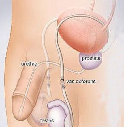La vasectomia mediante taglio dei dotti deferenti come metodo contraccettivo DEFINITIVO per gli uomini